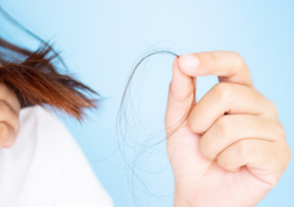 Hair Loss: Top Causes Your Clients May Be Facing